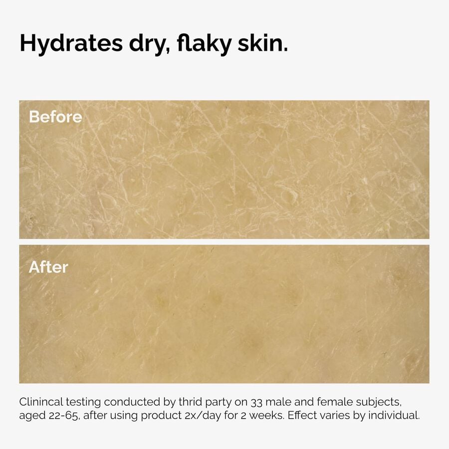 the-body-care-collection-z7 ord-natural-moisturizing-factors-inulin-body-before-after-graphic-02.jpg