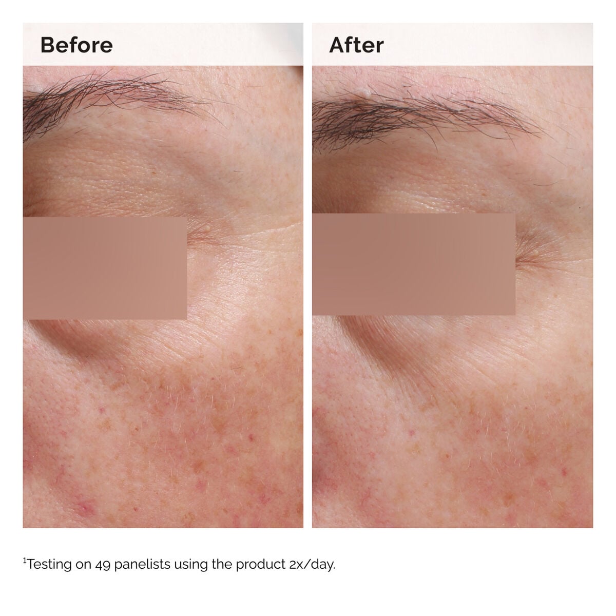 niacinamide-5-face-and-body-emulsion-o2 2024-08-23-ORD-Nia-5pct-Face-Body-B-A-Elasticity-Global-02-1x1.jpg