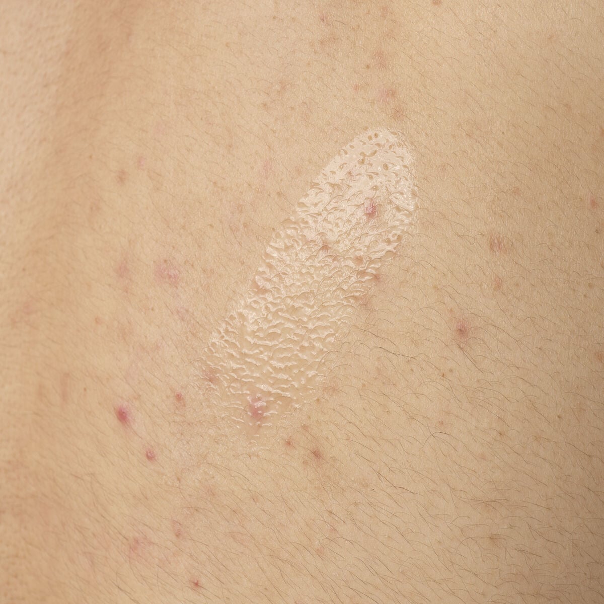 salicylic-acid-0-5-body-serum-w6 ORD-salicylic-acid-05-body-240ml-application.jpg