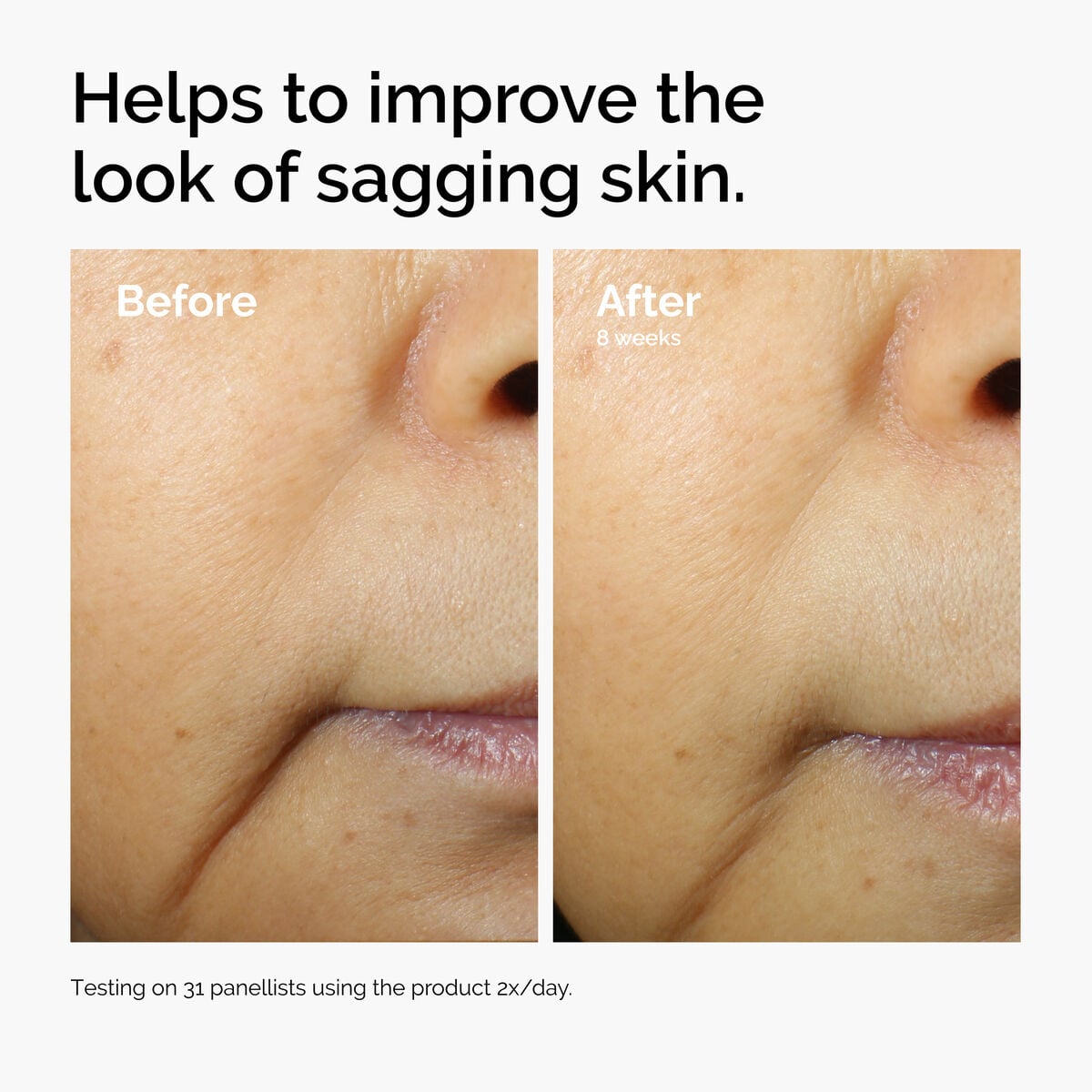 caffeine-3-escin-1-face-serum-o5 ord-caffeine-3pct-escin-1pct-face-serum-before-after-sagging.jpg