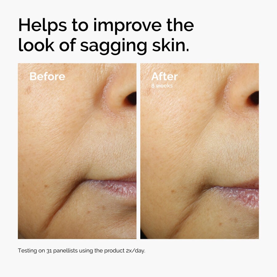 caffeine-3-escin-1-face-serum-r5 ord-caffeine-3pct-escin-1pct-face-serum-before-after-sagging.jpg