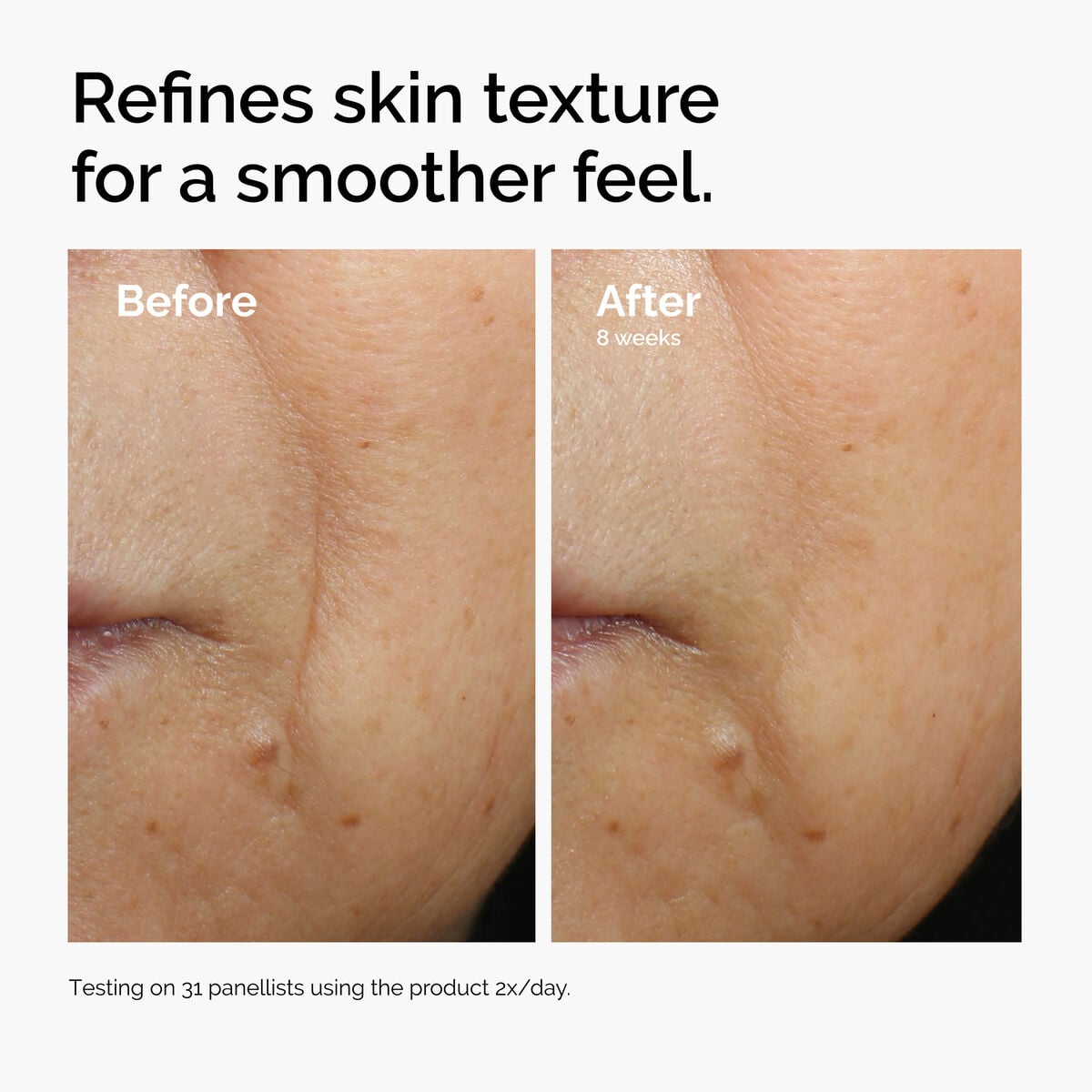 caffeine-3-escin-1-face-serum-o5 ord-caffeine-3pct-escin-1pct-face-serum-before-after-texture.jpg
