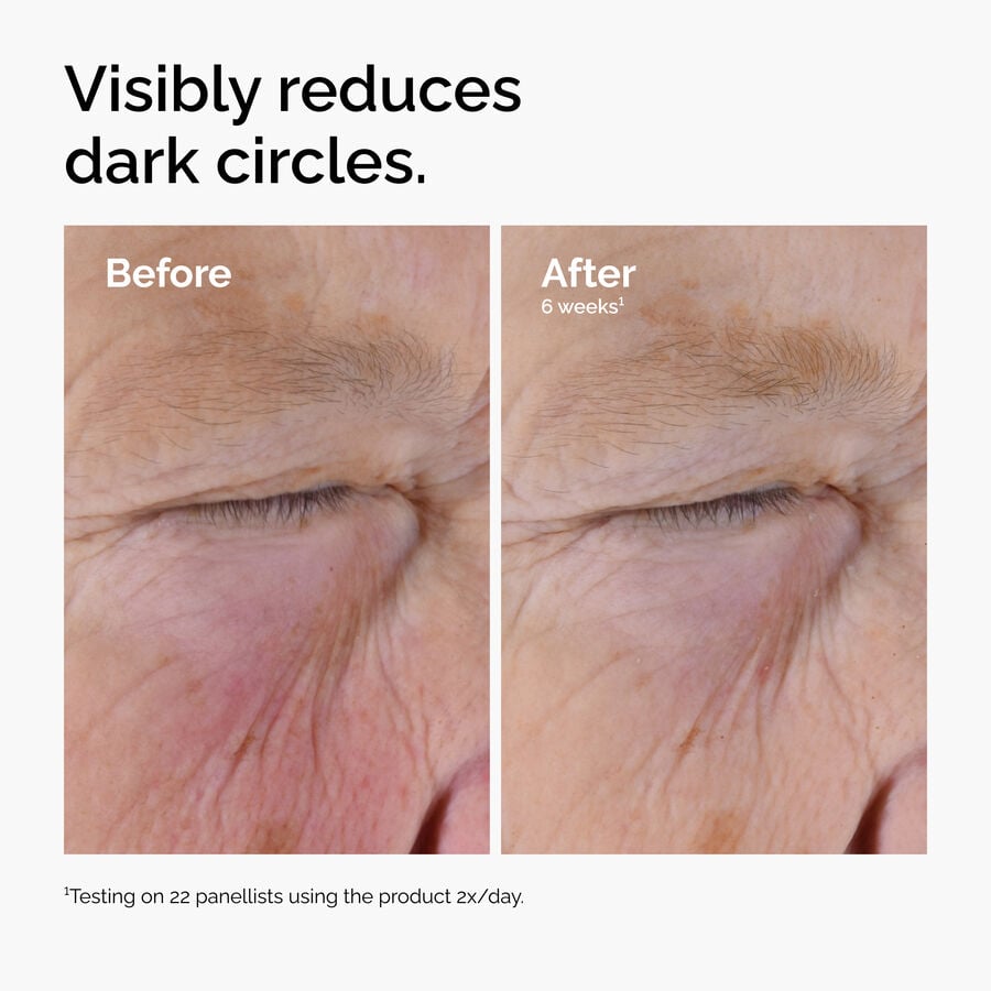 caffeine-solution-5-egcg-eye-serum-q7 ord-caffeine-solution-egcg-dark-circles-before-after.jpg