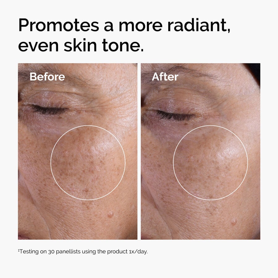 glycolic-acid-7-exfoliating-toner-h1 ord-glycolic-before-after-radiance.jpg