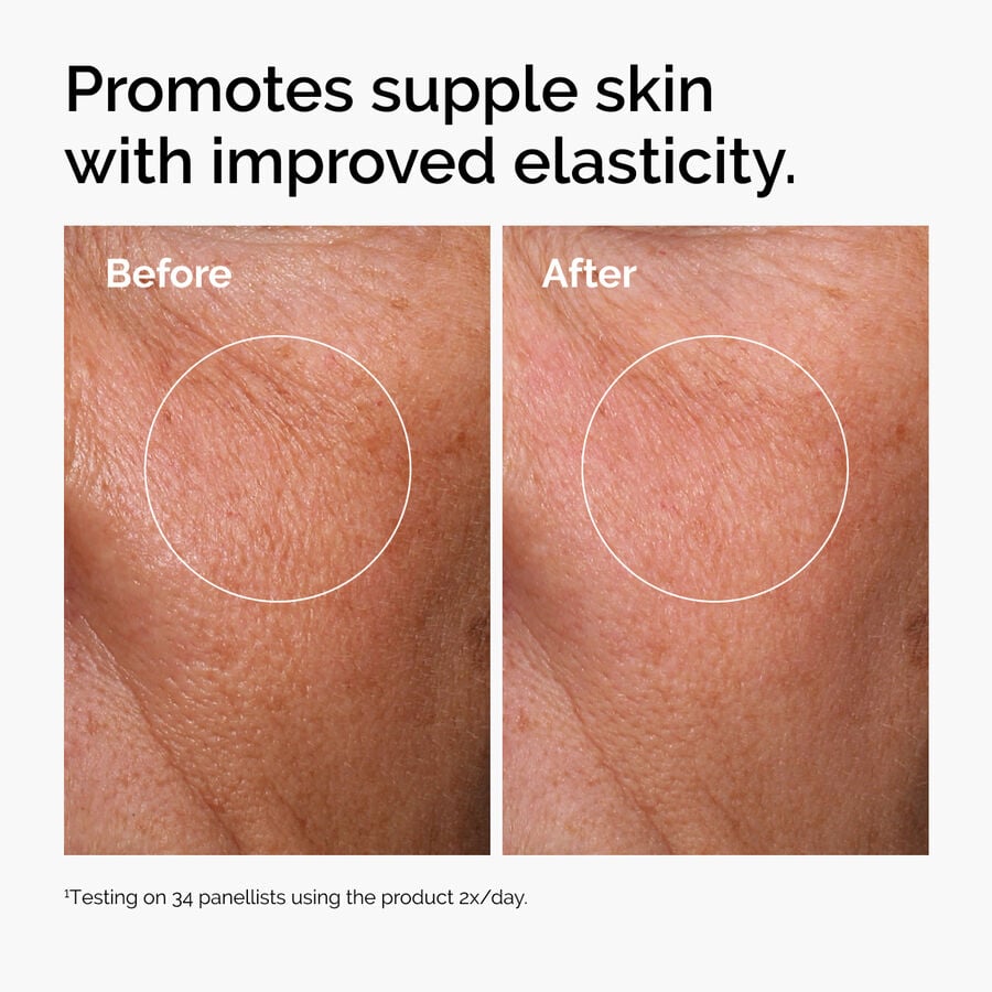 hyaluronic-acid-2-b5-with-ceramides-y0 ord-hyaluronic-acid-2pct-b5-hydrating-serum-before-after-elasticity.jpg