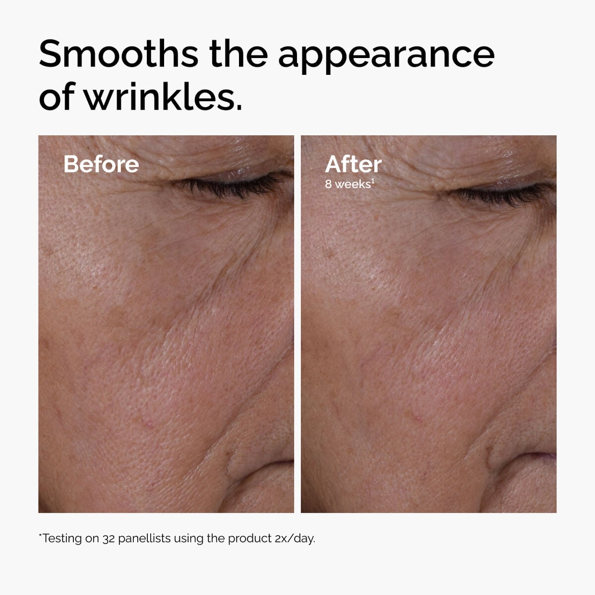 multi-peptide-ha-serum-n3 ord-multi-peptide-ha-serum-wrinkles-before-after.jpg