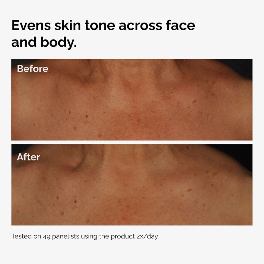 the-body-care-collection-i0 ord-niacinamide-face-body-serum-before-after-even-tone-graphic.jpg