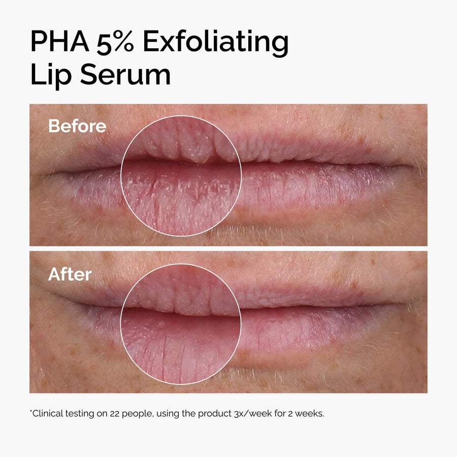 pha-5-exfoliating-lip-serum-z8 ord-pha-5pct-lip-exfoliating-serum-before-after.jpg