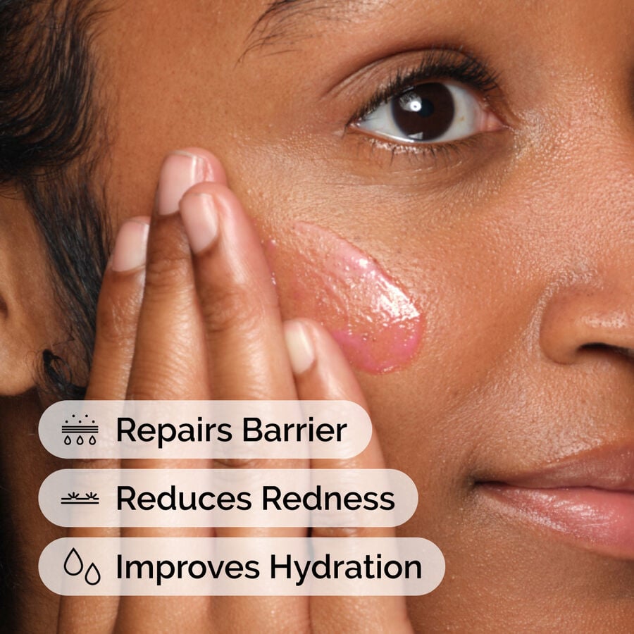 soothing-and-barrier-support-serum-set-h3 ord-soothing-barrier-support-serum-model-application-with-benefits.jpg